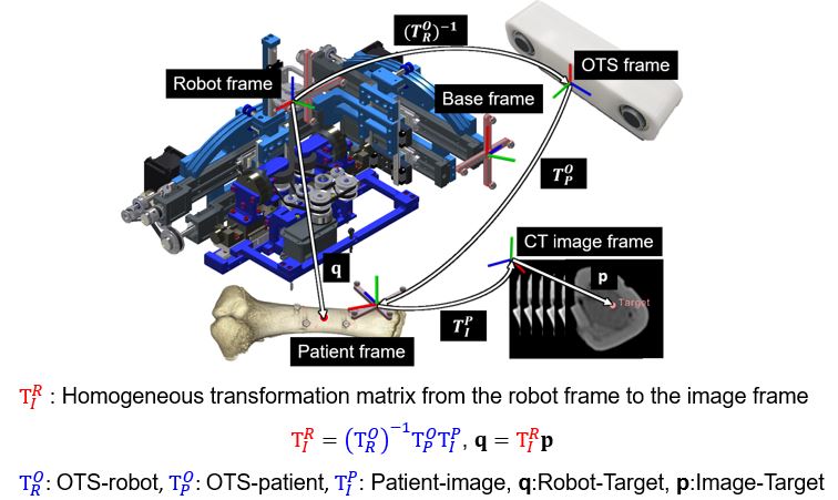 Bone Surgery Robot with High-resolution and High-rigidity – DGIST ...